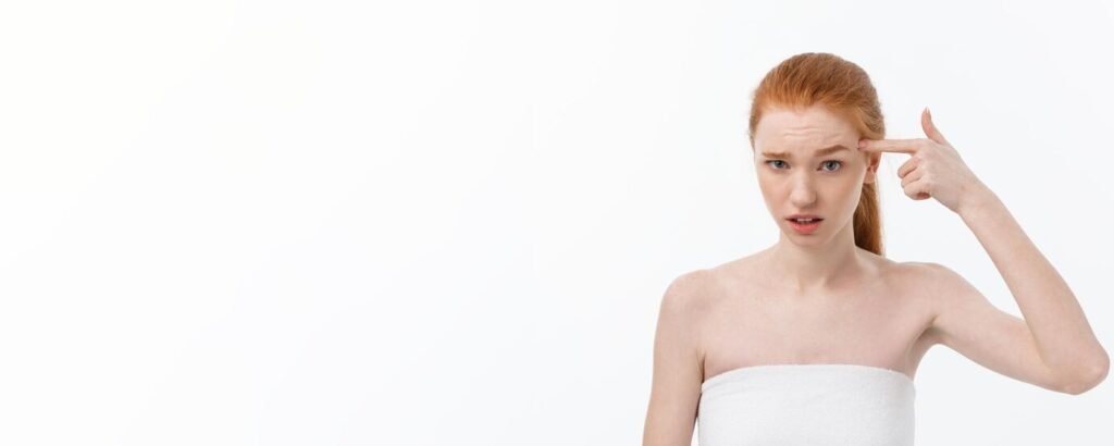 Acne Victory Plan: 05 Acne Treatment Before and After 6 Over-the-Counter Acne Treatment Before and After